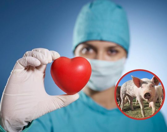 attachment heart transplant 540x426